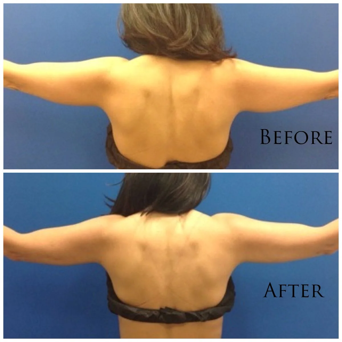 Before and after with XeiuC Collagen Oil